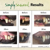 Simply Seaweed Dental Supplement – 200g